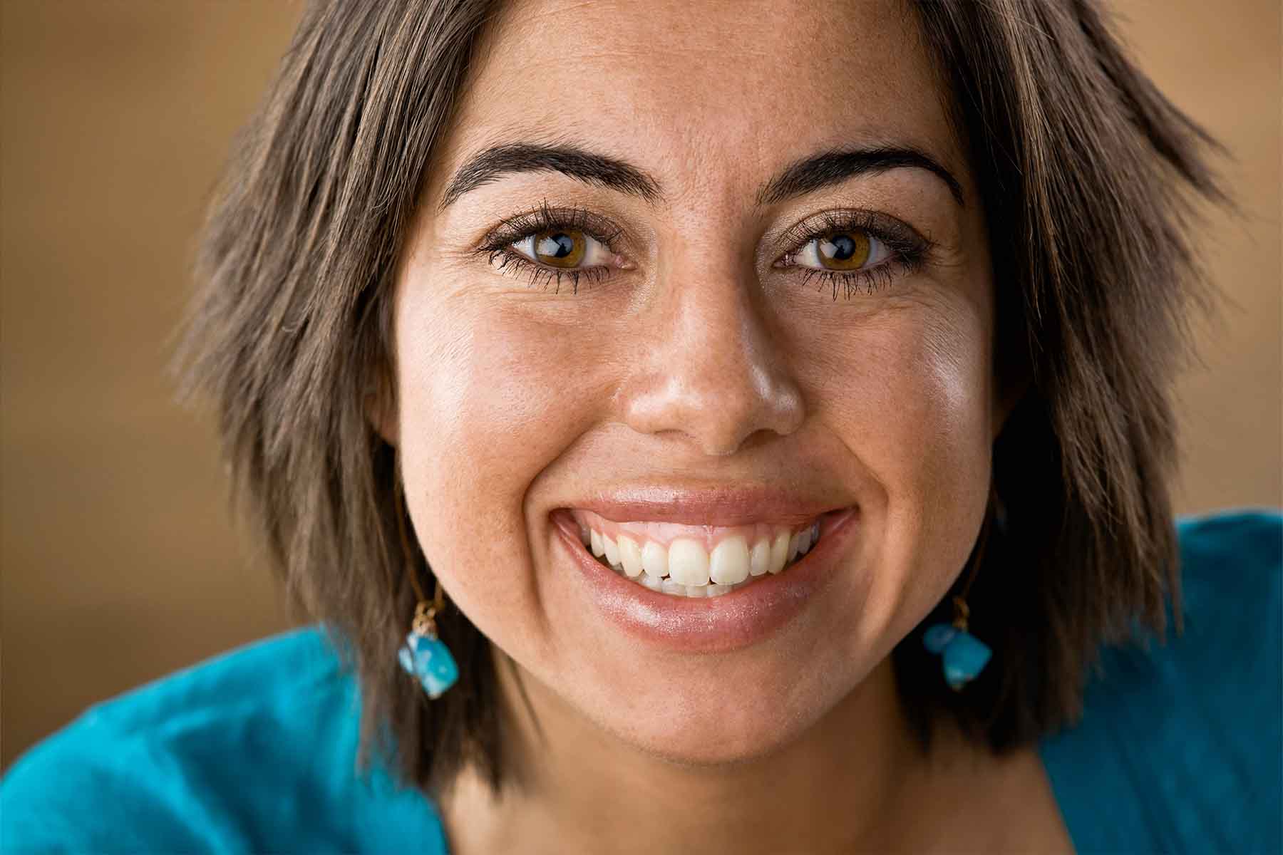 porcelain veneers langley