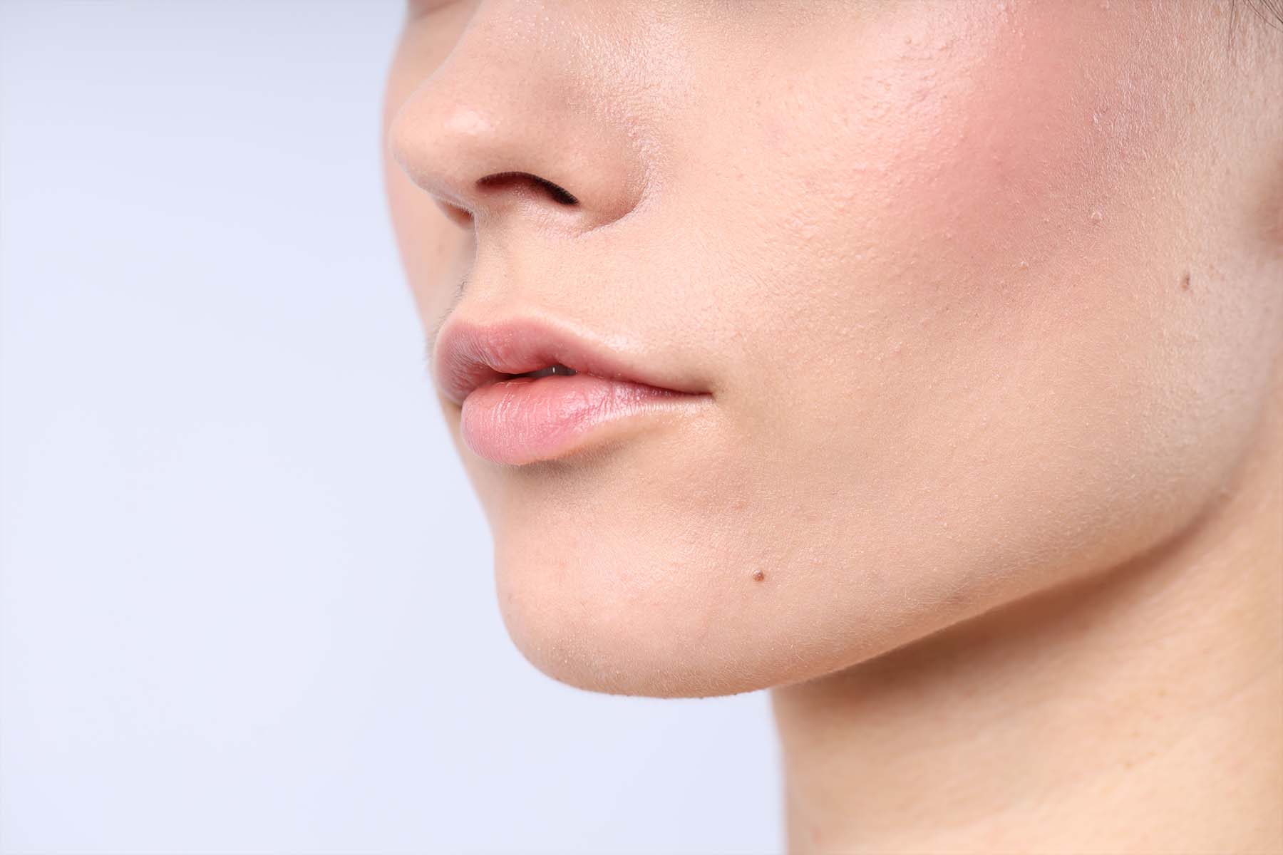 Dental Botox Langley