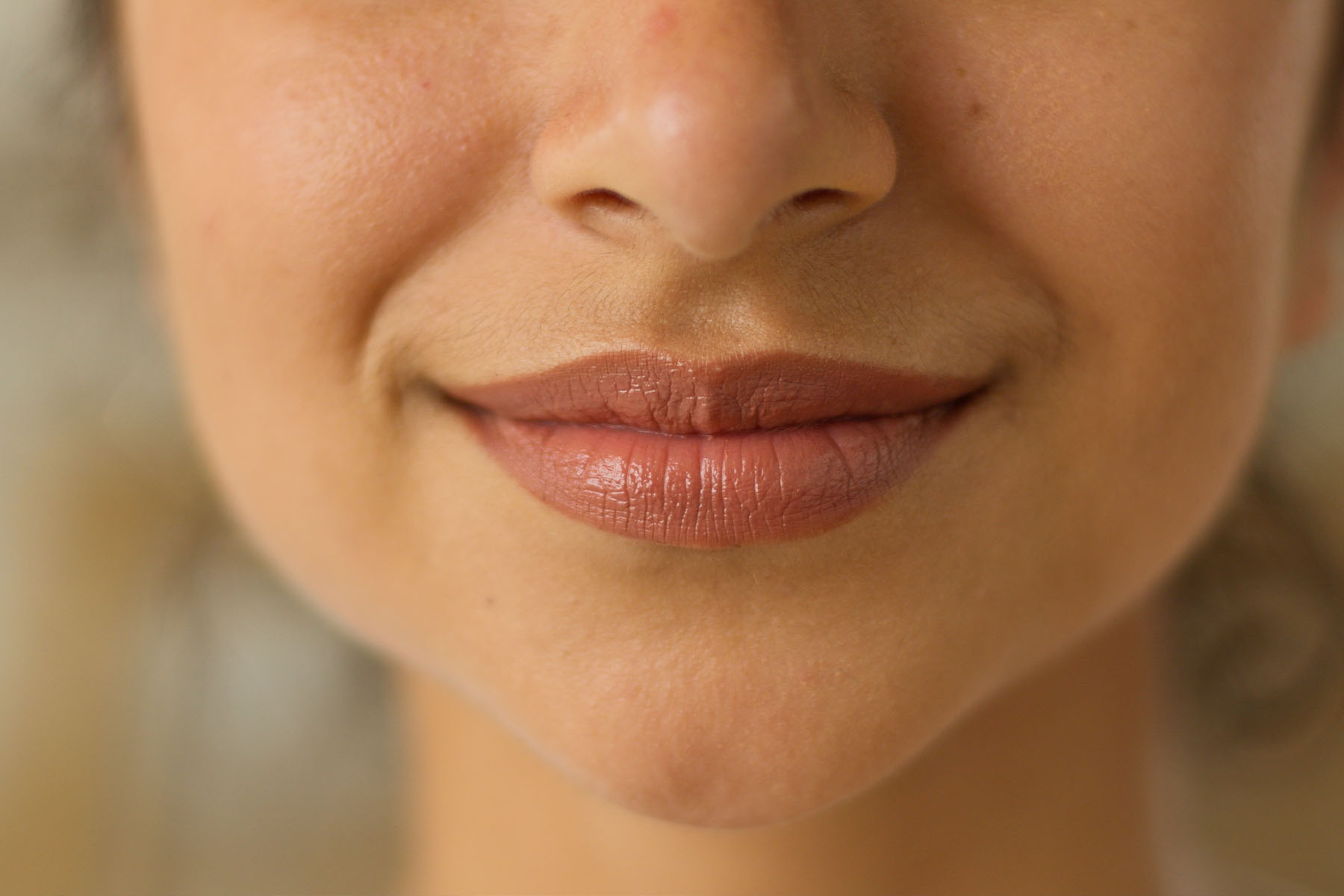 Dental Botox Langley