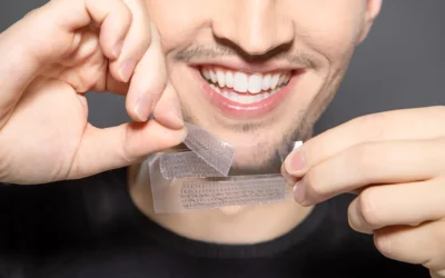 Professional Teeth Whitening vs. At-Home Kits: Which Is Better?