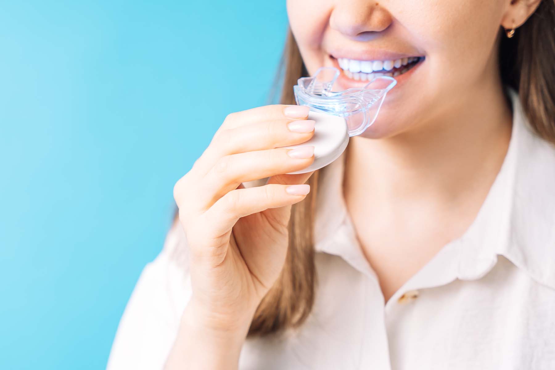 cosmetic dentist langley